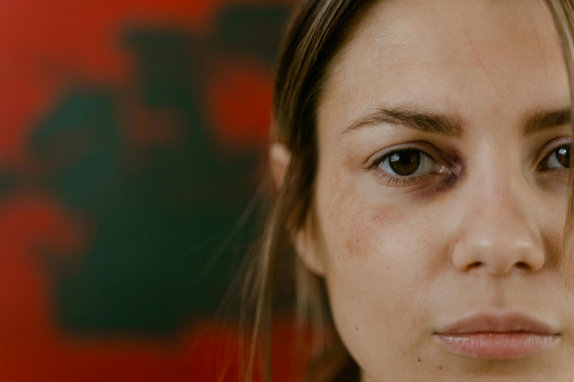Close-up portrait of a woman with a bruised eye, depicting emotion and resilience. - peter levine trauma healing